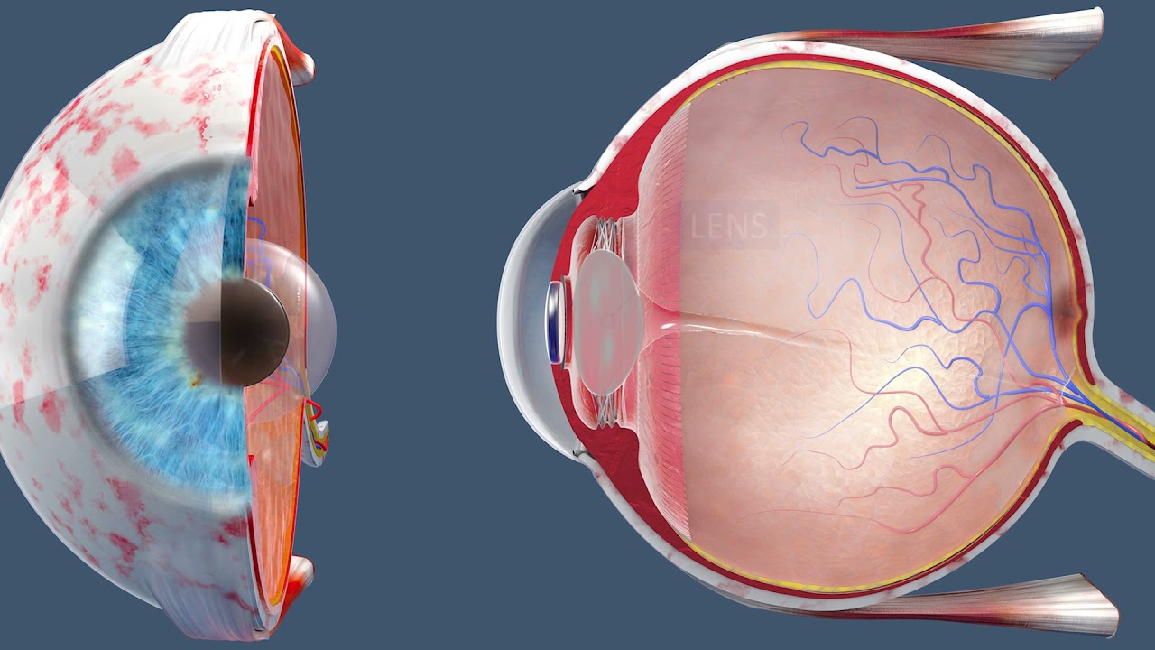 LASIK Risks and Complications