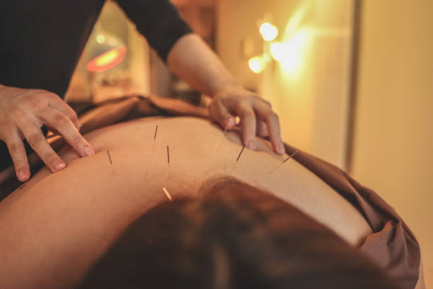 Understanding Acupuncture